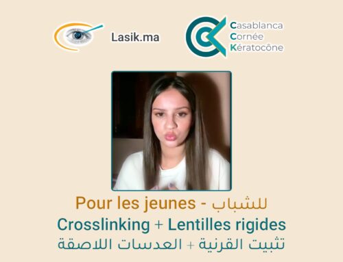 Témoignage vidéo 003 – Lentilles rigides – Crosslinking/Kératocône